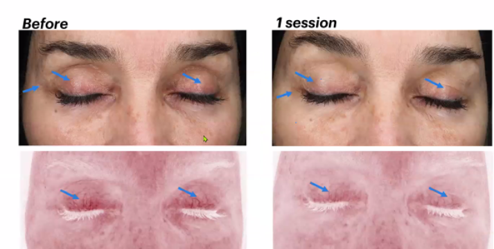 Eye Session